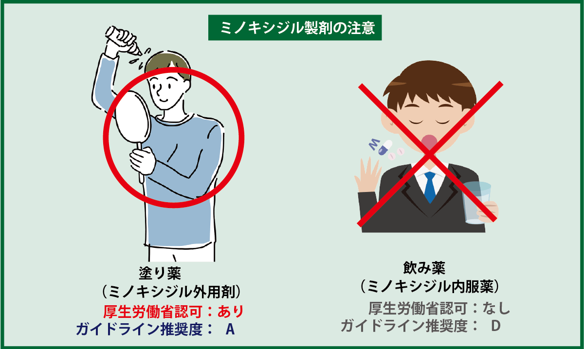 ミノキシジルは外用薬が推奨、内服は未認可の比較図