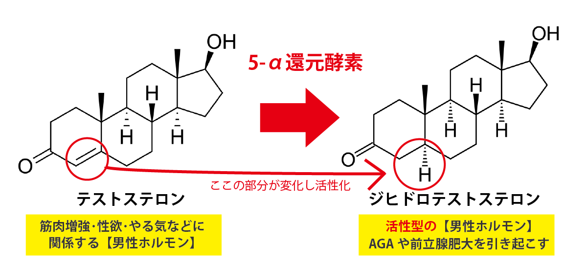 テストステロンとジヒドロテストステロン（DHT）の違いとAGAとの関係