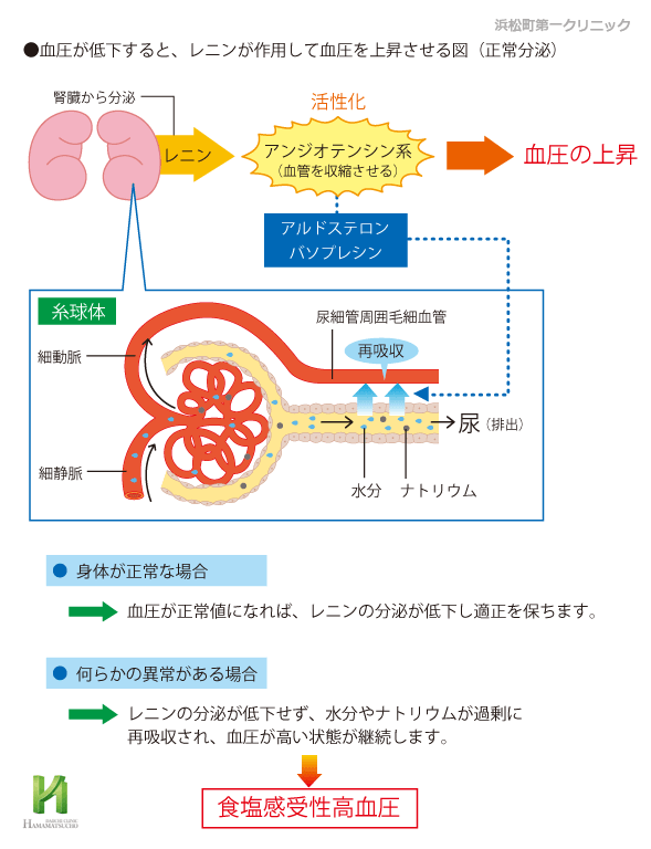 本態性高血圧 一次性高血圧 とed Edとは 浜松町第一クリニック