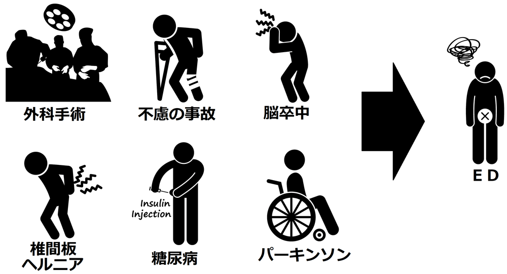 神経障害による器質性ED