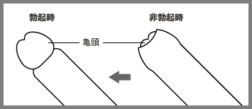 包茎とed Edとは 浜松町第一クリニック